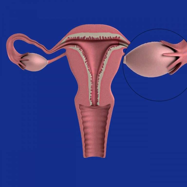 uterus-1089344_1280