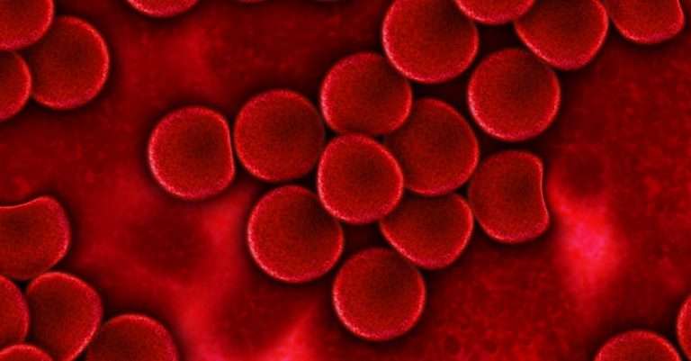 sangue