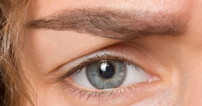 glaucoma