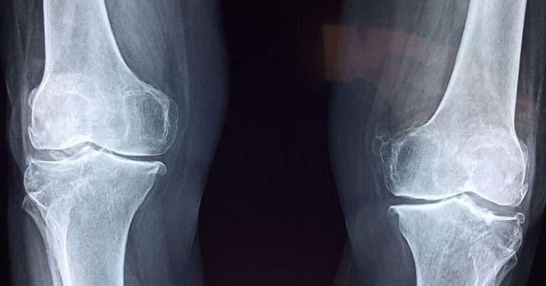 radiografia