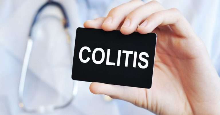 mici colite e malattia di crohn