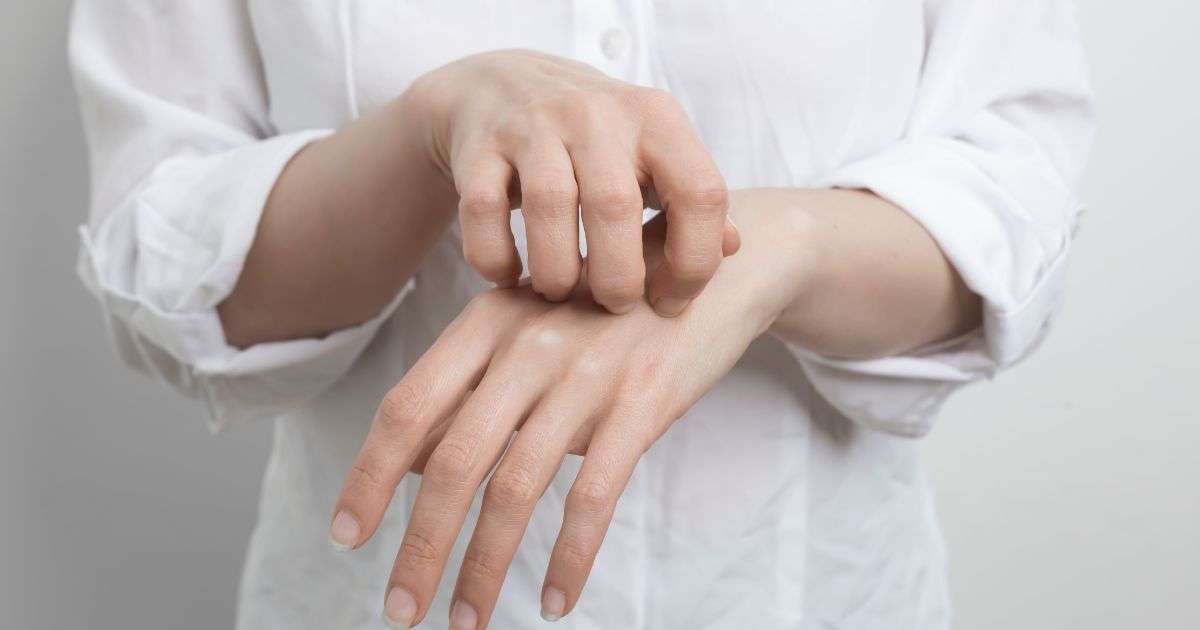 scabbia sulle mani