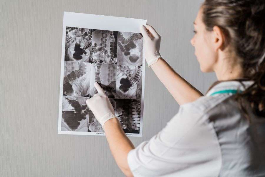 raggi x per individuare il tumore al colon retto
