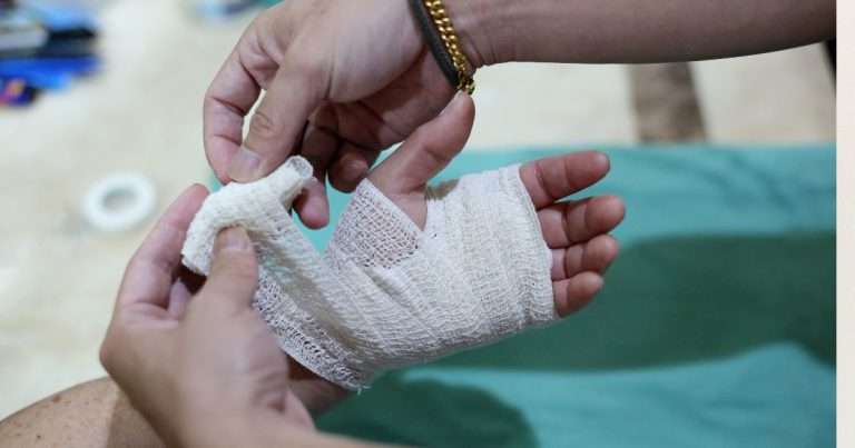 cure di ferite complesse ad una mano