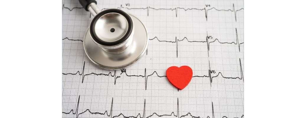 Giornata Mondiale per il Cuore, elettrocardiogramma e stetoscopio
