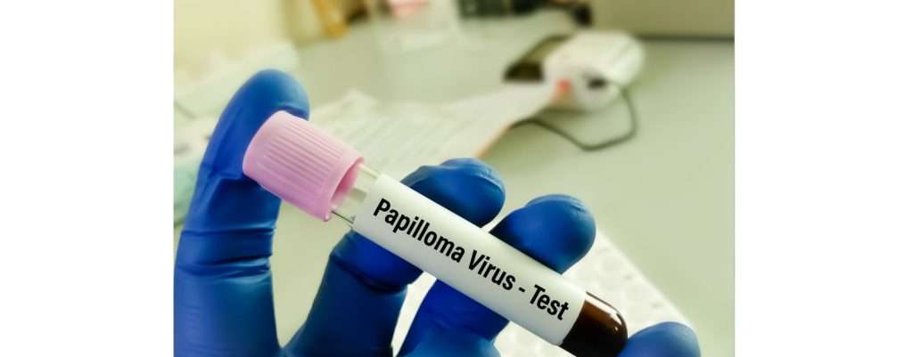 test del papilloma virus