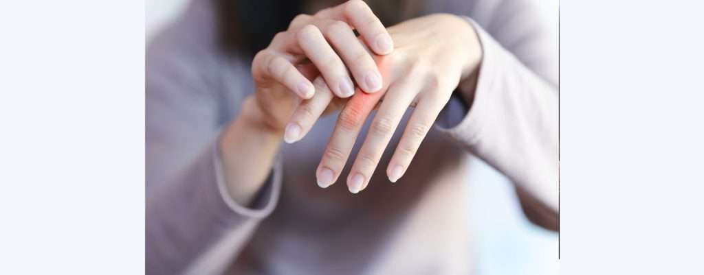 mani con malattie reumatologiche