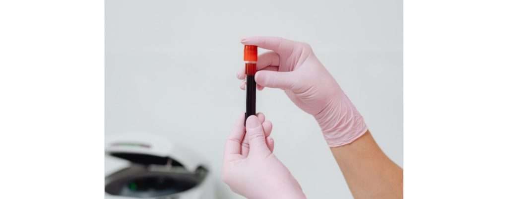 screening in farmacia